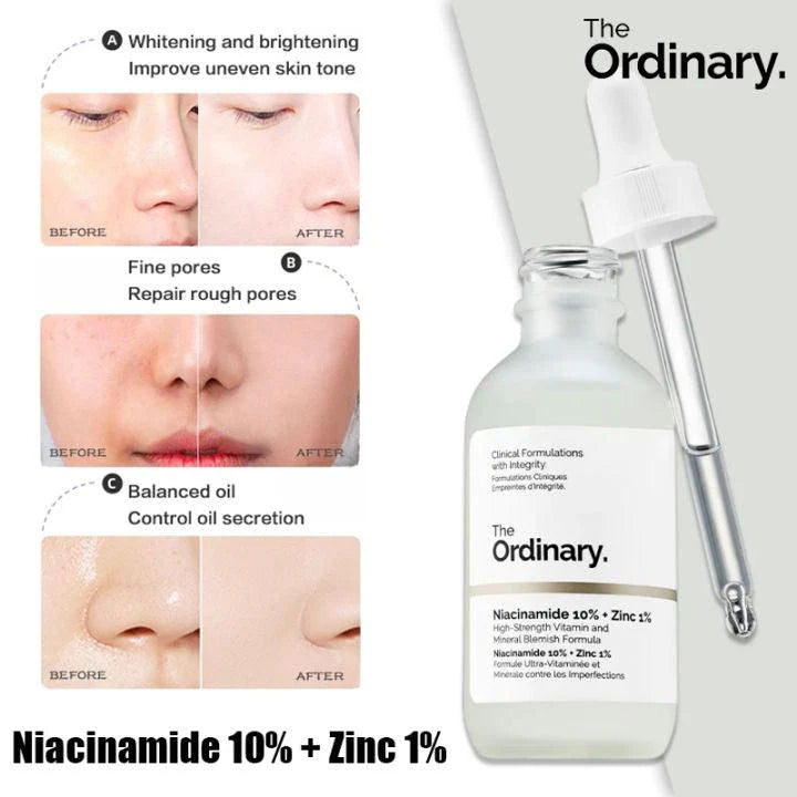 The Ordinary Serum Niacinamde 10% +Zinc 1%