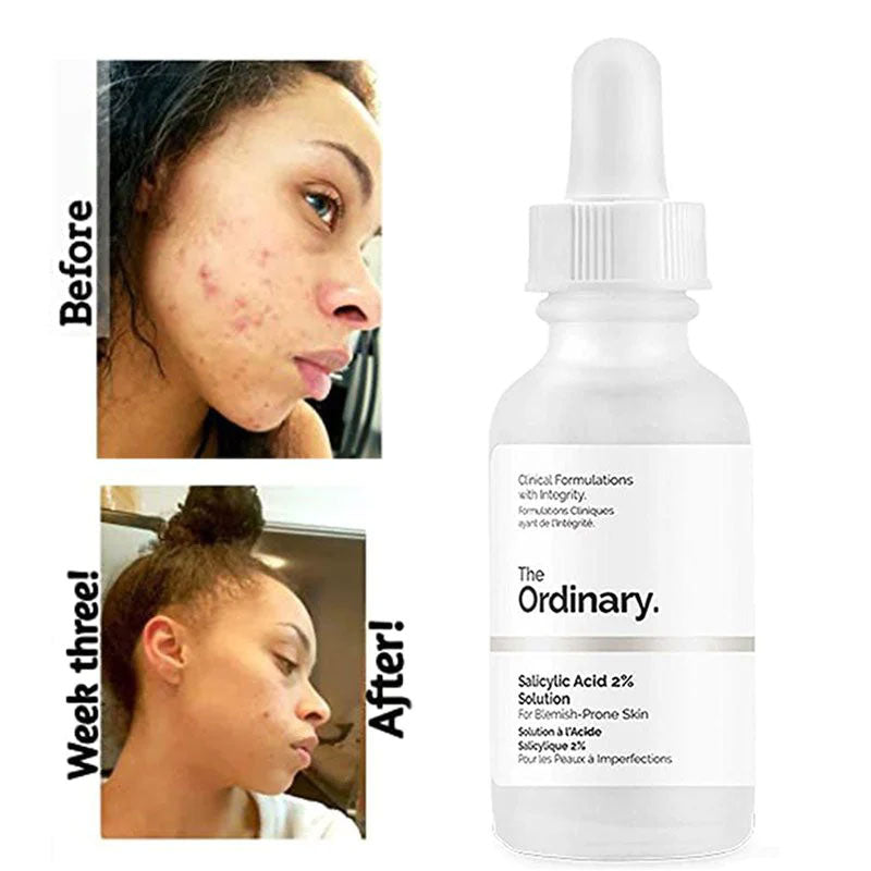 The Ordinary Salicylic Acid 2% Solution -30ml